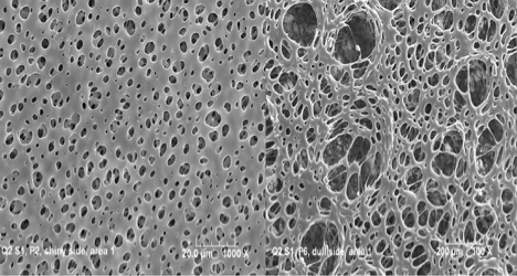 Depiction of Primecare™ Asymmetric Membrane illustrating 2-3µm pore size on membrane bottom and 40-50µm pores on membrane top.